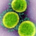 How Long Does the Coronavirus Survive on Surfaces?