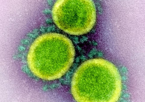 How Long Does the Coronavirus Survive on Surfaces?